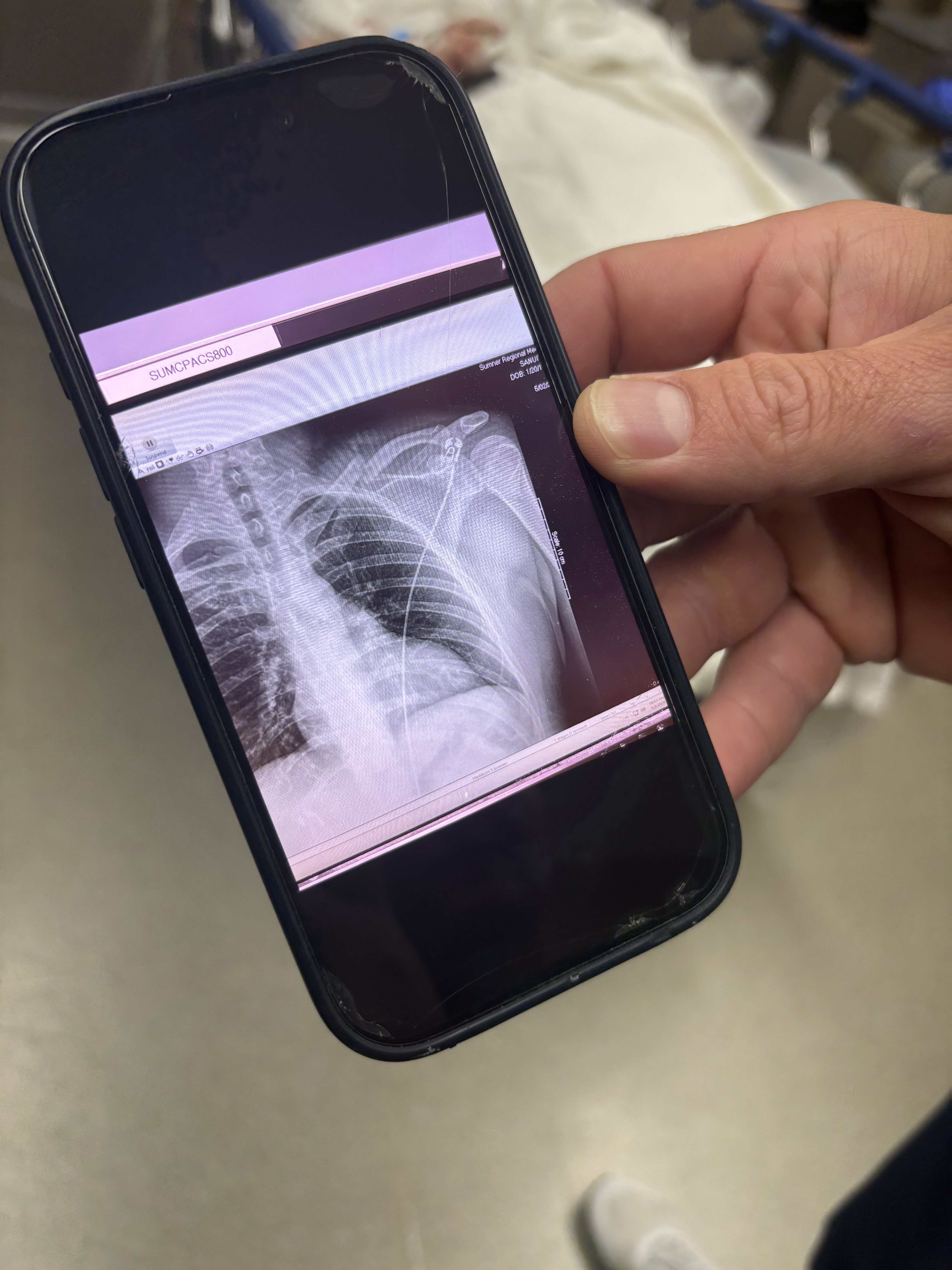 Shoulder Imaging