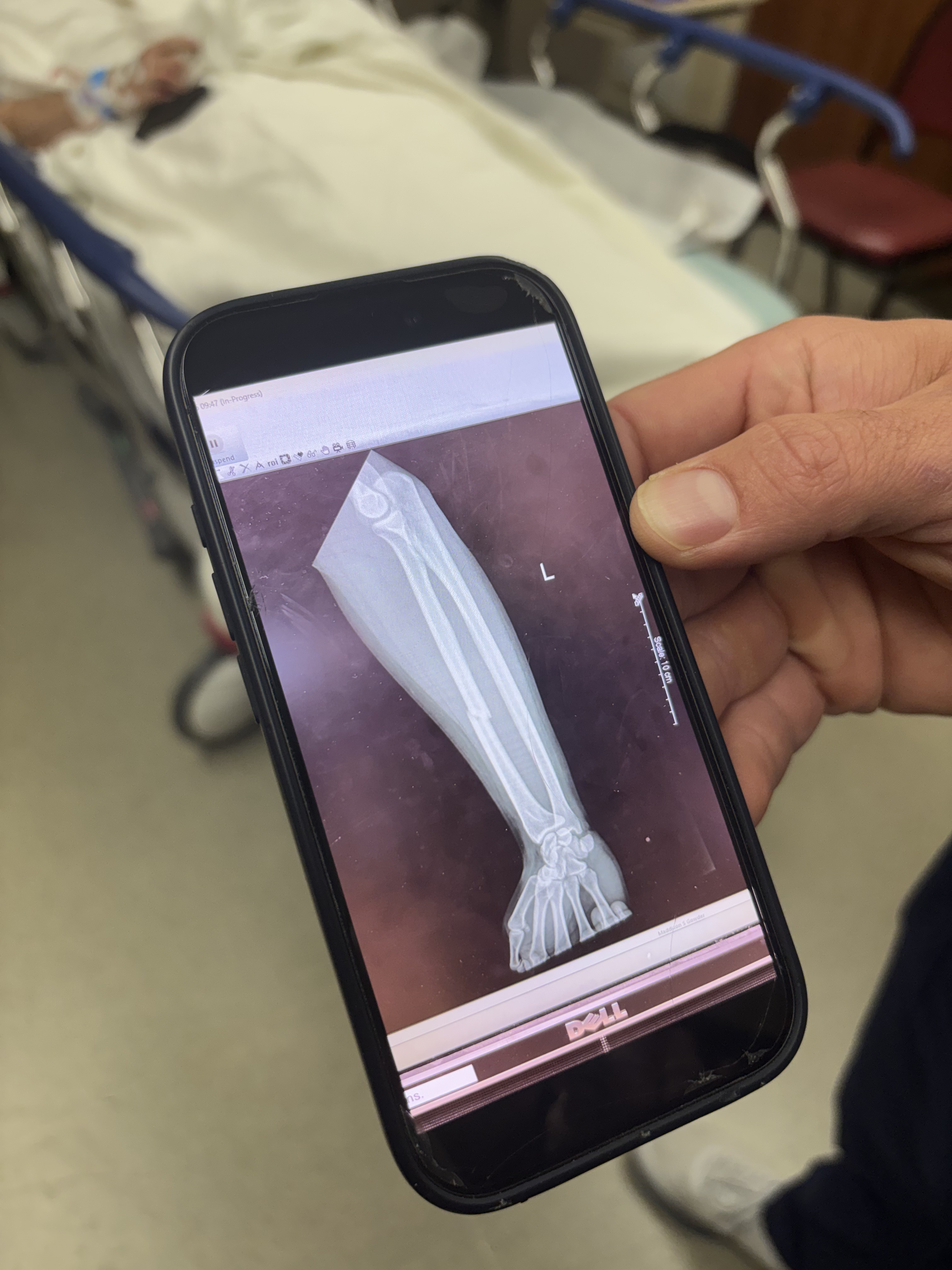 Arm Imaging